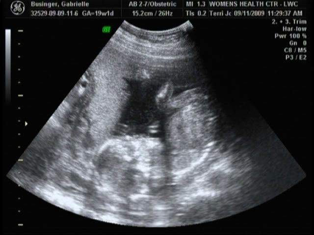 Brenley first picture