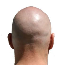 bald-head.jpg
