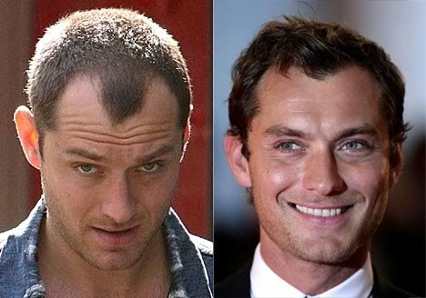 hairstyle for receding hairline. shows a receding hairline